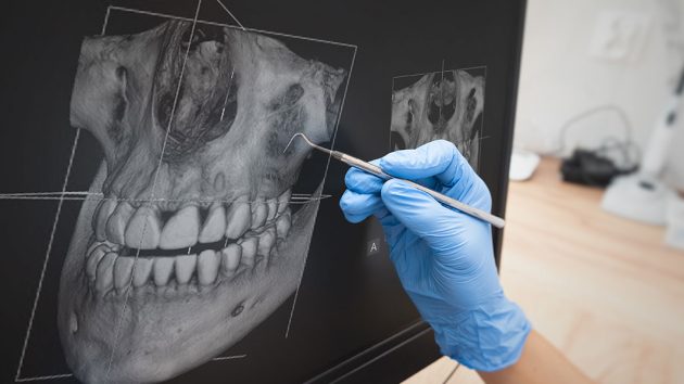 How Much Does Corrective Jaw Surgery Cost